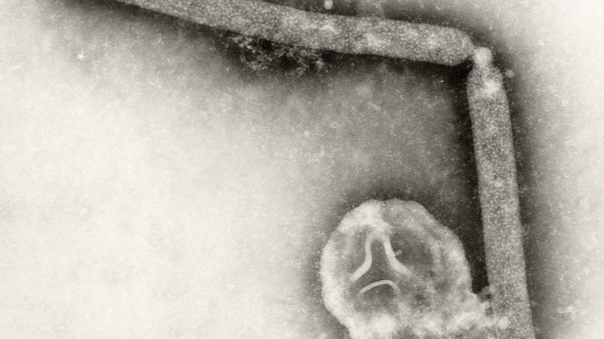 En esta imagen sin fecha, obtenida mediante un microscopio electrónico y proporcionada por los Centros para el Control y la Prevención de Enfermedades (CDC, por sus siglas en inglés), se muestran dos viriones de la influenza A (H5N1), un tipo de gripe aviar