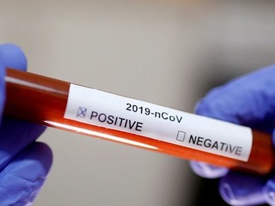 Tres casos nuevos de coronavirus en Loncopué