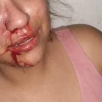 Soy Alina y temo por mi vida porque mi esposo se volvió mi agresor, denuncia la mujer en redes