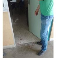 Alumno del CCH Naucalpan apuñala en el brazo y cuello a profesor