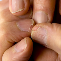 Basta de uñas quebradizas: con 1 ingrediente de tu cocina, conseguí que tu Nail Art luzca hermoso por varias semanas
