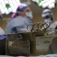Medicamentos para bajar de peso podrían elevar los riesgos bajo anestesia