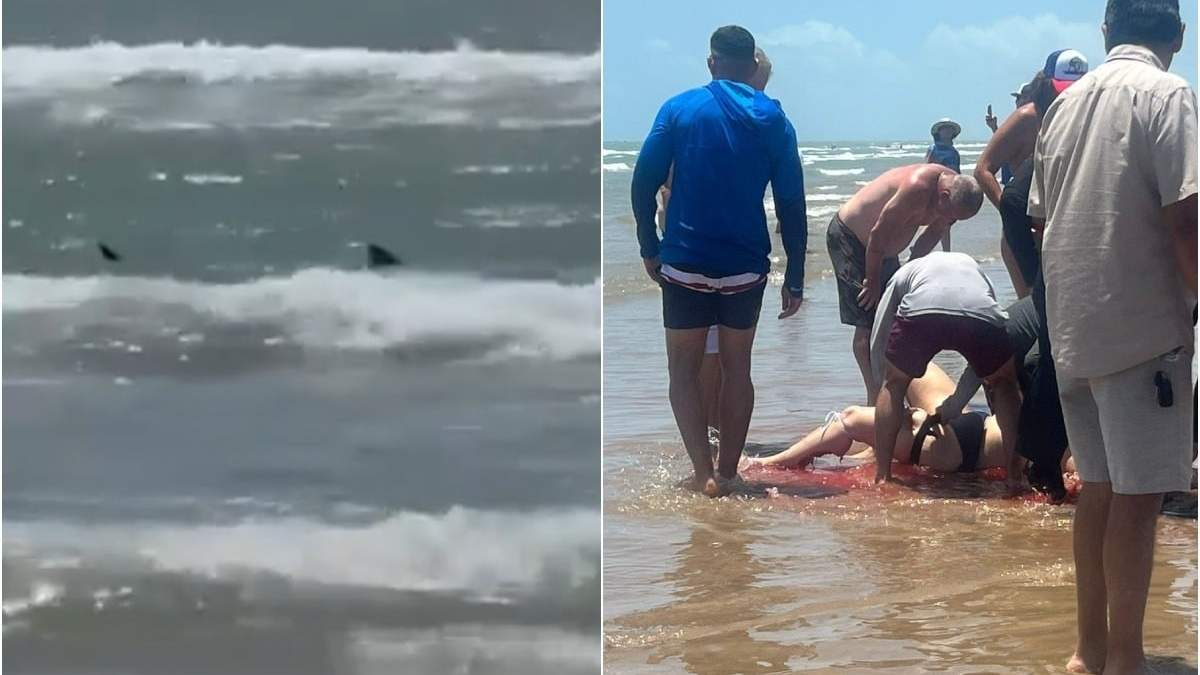 Ataque de tiburón
