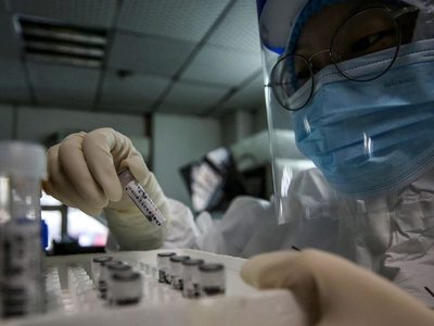 Coronavirus: crece la demanda de tests en clínicas y laboratorios privados