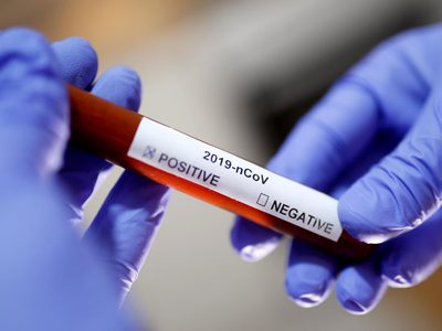 Quienes convivan con un infectado serán declarados casos positivos de coronavirus