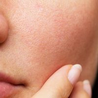 Tu piel merece otra oportunidad: la forma natural de eliminar las manchas más odiosas