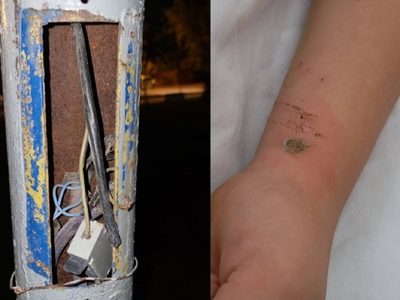 Un niño recibió una descarga eléctrica al abrazar un poste en una plaza de Centenario