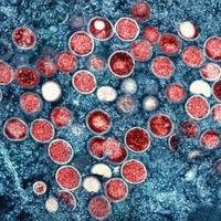 Viruela del mono: Esta es la principal forma de contagio, concluyen expertos