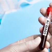 Loncopué: el coronavirus analizado a través de 70 testeos