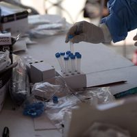 Vitamina D reduce el riesgo de muerte o enfermedad grave por covid-19, concluye estudio