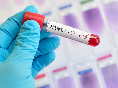 La gripe H1N1 podría descender de la cepa que causó la pandemia mortal de 1918