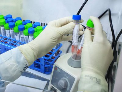 Alerta: Salud confirmó 17 nuevos casos de la variante Delta