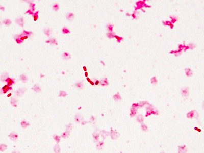 Secretaría de Salud emite alerta epidemiológica por la bacteria Klebsiella oxytoca