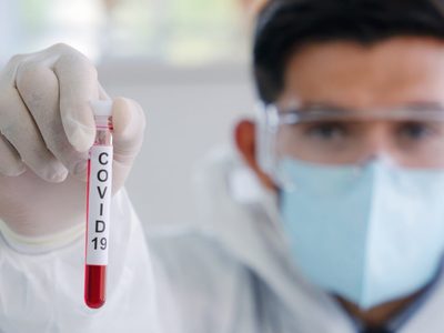 Coronavirus: la provincia de Neuquén registra 15 positivos cada 100 personas