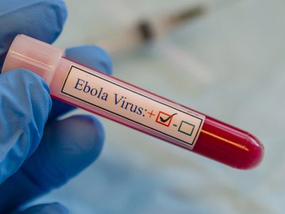 Alerta máxima en África: un nuevo brote de ébola se propaga en Guinea