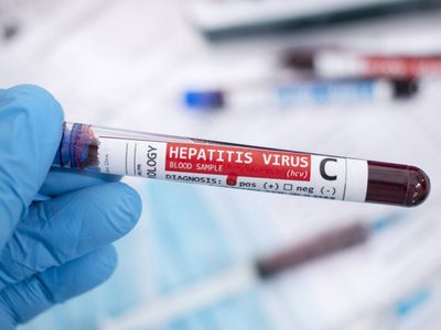 Ante las sospechas de hepatitis aguda, Salud pidió completar los esquemas de vacunación