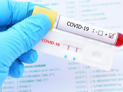 Coronavirus: Neuquén confirmó 6 nuevos casos y 15 pacientes recuperados