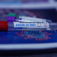 Récord total: un paciente en el Reino Unido dio positivo en coronavirus durante más de 500 días