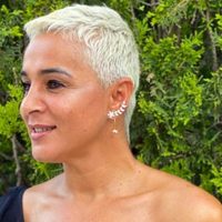 Con una nueva imagen: Ana María Aldón se sometió a un nuevo tratamiento estético