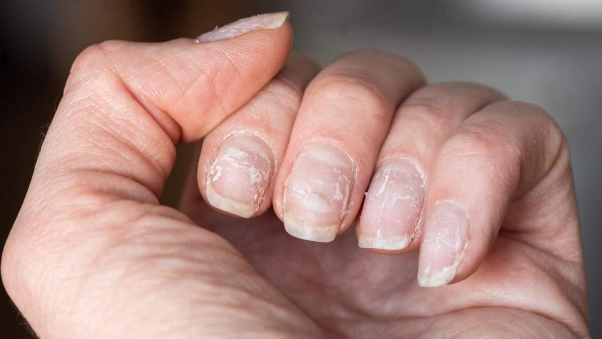 Uñas. Fuente: (X)