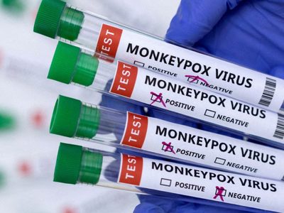 Por primera vez, Estados Unidos detectó casos de viruela del mono en niños