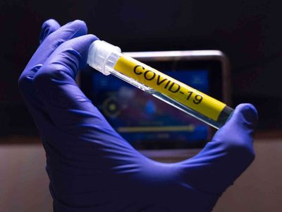 La vacuna contra el COVID 19, una medida necesaria aún a 2 años de su instauración