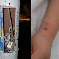Un niño recibió una descarga eléctrica al abrazar un poste en una plaza de Centenario
