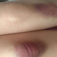 Líder juvenil del PRI en Aguascalientes es denunciado por su novia tras golpiza; partido lo suspende