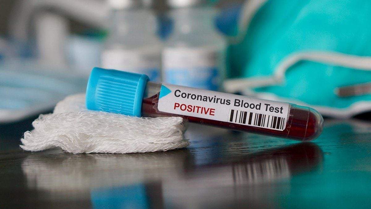 Reporte diario de coronavirus. Fuerte: (Twitter)
