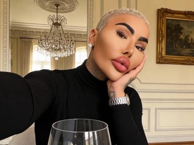 Muere Jordan James Parke, influencer que gastó miles de dólares para parecerse a Kim Kardashian