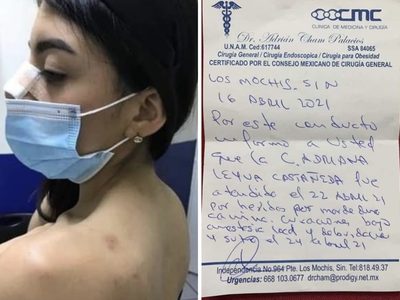 La novia del hombre que mató al perro "Rodolfo" intenta justificar la agresión y luego se deslinda