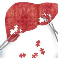 Fue detectado el primer caso de hepatitis aguda: ya van 169 casos en 12 países