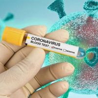 Las ciudades neuquinas que cuentan con transmisión comunitaria de coronavirus
