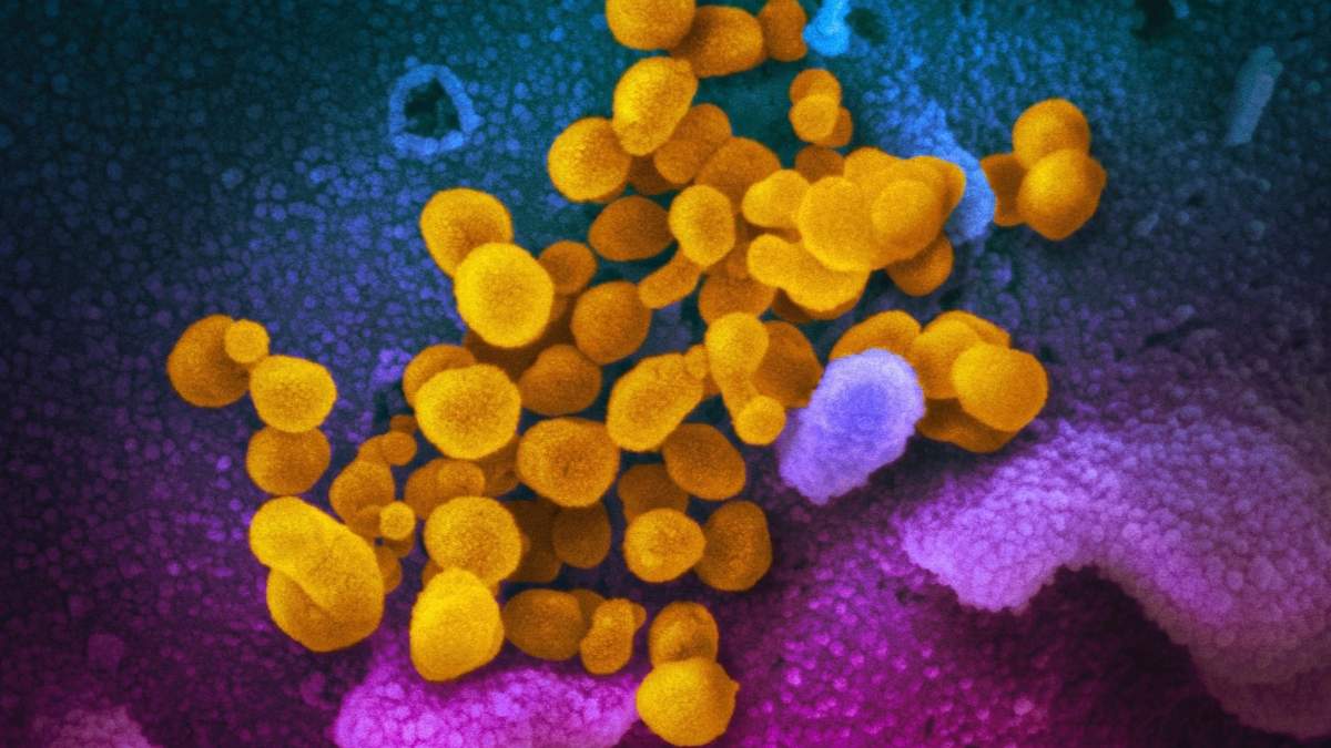 Células de coronavirus, indicadas en amarillo