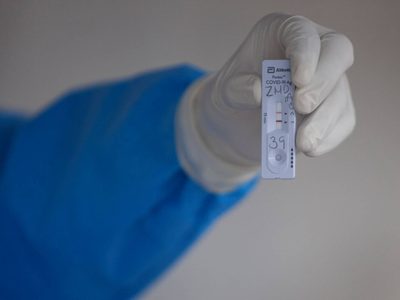 El coronavirus comienza a repuntar: en un día, 332 muertos y 3 mil 836 contagios