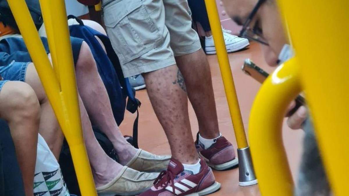 El hombre fue expuesto en redes sociales por un médico
