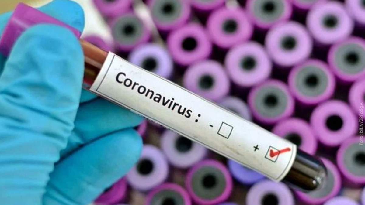 Imagen ilustrativa de un test positivo de coronavirus. Fuente: (Twitter)