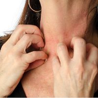 Alergia emocional: cuando el cuerpo reacciona con síntomas físicos a situaciones afectivas