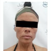 Vinculan a proceso a mujer que presuntamente asesinó a su pareja a martillazos