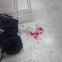 Un menor se dispara en la mano al manipular una pistola que llevó a su escuela en Iztapalapa