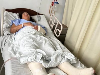 Buscan repatriar a una argentina que cayó de un tercer piso en México