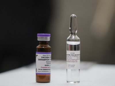 Suman 31 fallecidos por sarampión en México