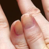 Si ya no sabés qué hacer para que tus uñas crezcan, probá este milagroso truco de las abuelas que nunca falla