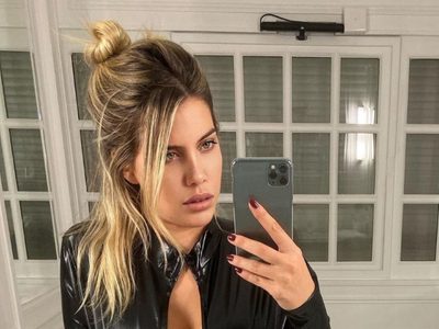 Wanda Nara, en una encrucijada: un experto en cirugía estética habría desmentido sus últimas declara