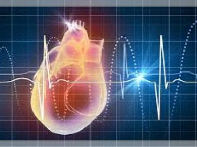 Investigadores de Japón hallan las células inmunitarias que causan infartos potencialmente mortales