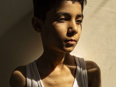 "¿Cómo podré abrazarte?": el retrato del niño gazatí con los brazos amputados, mejor foto del año