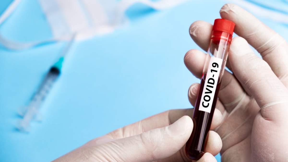Coronavirus. Fuente: (Twitter)