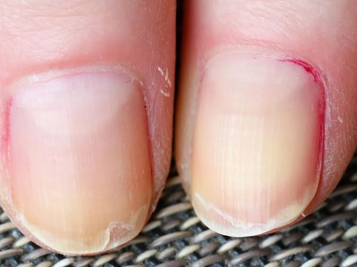 El consejo de las expertas en manicura para curar y sanar tus uñas si se abren por capas y están resecas