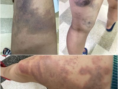 Judo en Jalisco: el maltrato oculto detrás de los triunfos