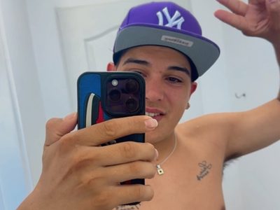 Thiago Medina mostró las cicatrices de su accidente